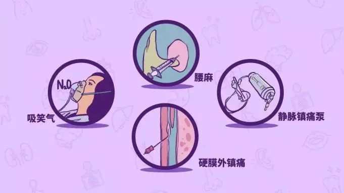 分娩镇痛的方式