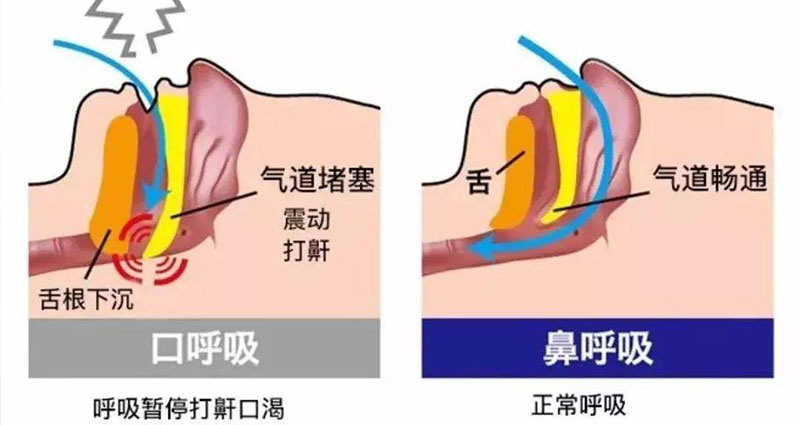 不孕不育原因(打呼嚕是導致男性不育的兇手嗎?