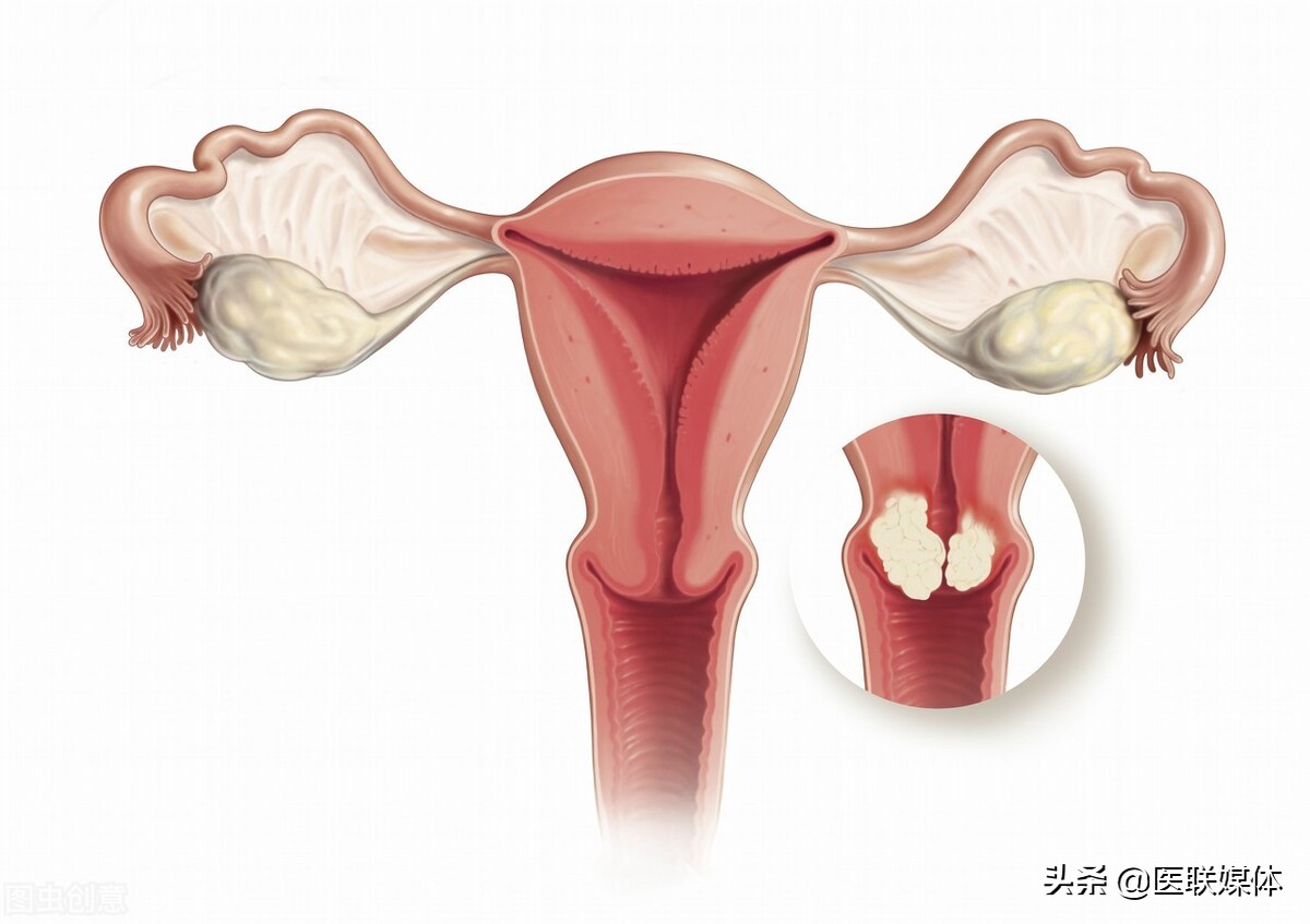 女人缺乏黃體酮,身體會有